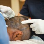 Why Hair Transplant Surgery In Turkey Is So Cheap